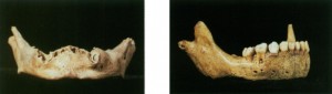 Figure 2: 2-3 y.o. Homo sapiens (left) and 3-4 y.o. Neanderthal (right) mandibles. Notice that the Homo sapiens specimen has spaces only for the incisors and canines only in the alveolar process while the Neanderthal has incisors, canines, and premolars due to selective pressure for earlier tooth development (Tattersall 7118).